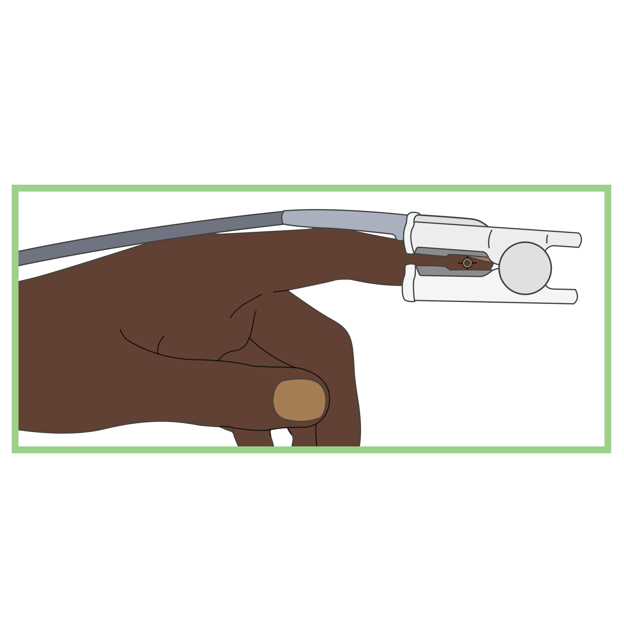 Finger Pulse Oximeter